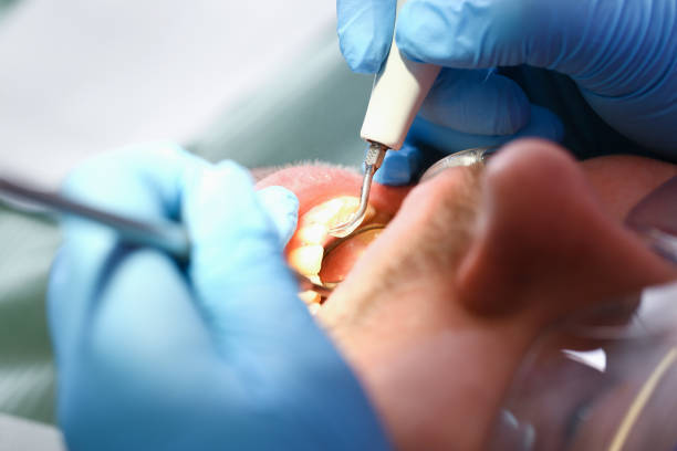 Best Root Canal Emergency Dentist  in Yorklyn, PA