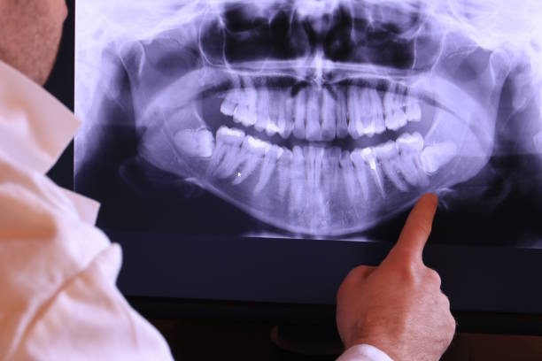 Best Cracked Tooth Emergency Dentist  in Yorklyn, PA