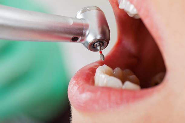Best Cracked Tooth Emergency Dentist  in Yorklyn, PA